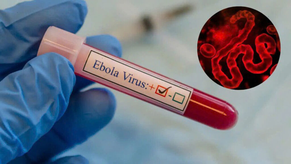 Ebola en RDC : arrêtons d’attendre, agissons pour briser les chaînes de transmission